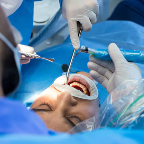 Oral & Maxillofacial Surgery